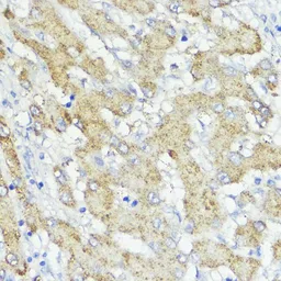 Anti-SOCS6 antibody used in IHC (Paraffin sections) (IHC-P). GTX65551