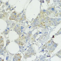 Anti-SOCS6 antibody used in IHC (Paraffin sections) (IHC-P). GTX65551