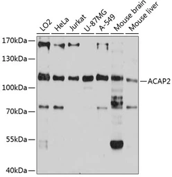 Anti-ACAP2 antibody used in Western Blot (WB). GTX65554