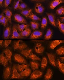 Anti-ACAP2 antibody used in Immunocytochemistry/ Immunofluorescence (ICC/IF). GTX65554