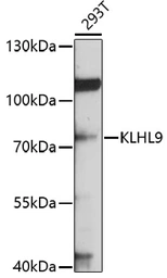 Anti-KLHL9 antibody used in Western Blot (WB). GTX65557