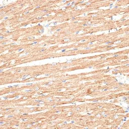 Anti-KLHL9 antibody used in IHC (Paraffin sections) (IHC-P). GTX65557
