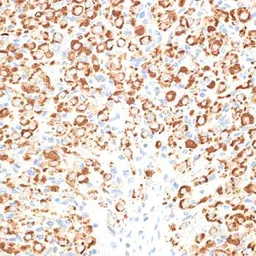 Anti-KLHL9 antibody used in IHC (Paraffin sections) (IHC-P). GTX65557