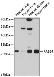 Anti-RAB34 antibody used in Western Blot (WB). GTX65558
