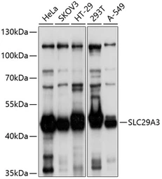 Anti-SLC29A3 antibody used in Western Blot (WB). GTX65559