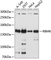 Anti-RBM6 antibody used in Western Blot (WB). GTX65560