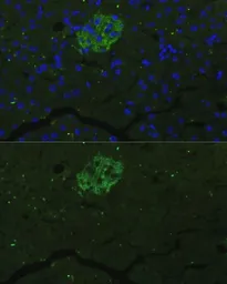 Anti-FAM3B antibody used in IHC (Paraffin sections) (IHC-P). GTX65562