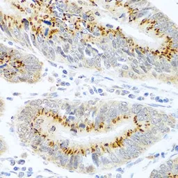 Anti-FAM3B antibody used in IHC (Paraffin sections) (IHC-P). GTX65562