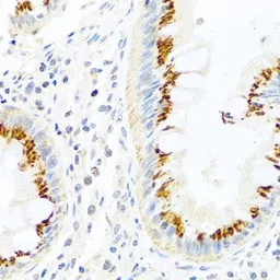 Anti-FAM3B antibody used in IHC (Paraffin sections) (IHC-P). GTX65562