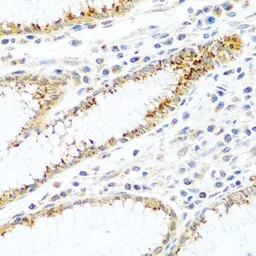 Anti-FAM3B antibody used in IHC (Paraffin sections) (IHC-P). GTX65562