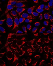 Anti-OCIAD1 antibody used in Immunocytochemistry/ Immunofluorescence (ICC/IF). GTX65565