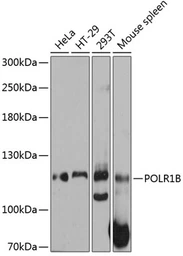 Anti-POLR1B antibody used in Western Blot (WB). GTX65567