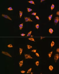 Anti-SPRR3 antibody used in Immunocytochemistry/ Immunofluorescence (ICC/IF). GTX65568