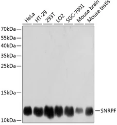 Anti-SNRPF antibody used in Western Blot (WB). GTX65570