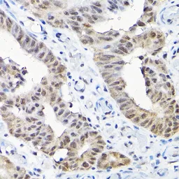Anti-SNRPF antibody used in IHC (Paraffin sections) (IHC-P). GTX65570