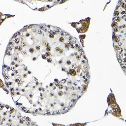 Anti-SNRPF antibody used in IHC (Paraffin sections) (IHC-P). GTX65570