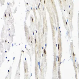 Anti-SNRPF antibody used in IHC (Paraffin sections) (IHC-P). GTX65570