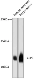 Anti-CLPS antibody used in Western Blot (WB). GTX65575