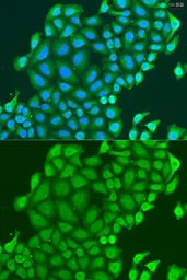 Anti-HAUS6 antibody used in Immunocytochemistry/ Immunofluorescence (ICC/IF). GTX65582