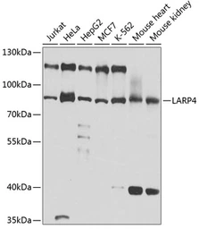 Anti-LARP4 antibody used in Western Blot (WB). GTX65583