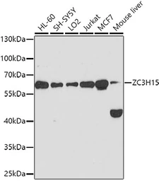 Anti-ZC3H15 antibody used in Western Blot (WB). GTX65585