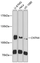 Anti-CNTN4 antibody used in Western Blot (WB). GTX65586