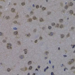 Anti-POLR2L antibody used in IHC (Paraffin sections) (IHC-P). GTX65590