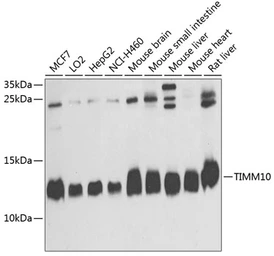 Anti-TIMM10 antibody used in Western Blot (WB). GTX65592