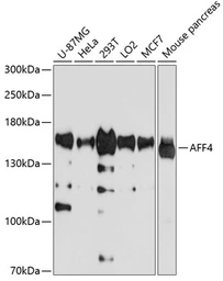 Anti-AFF4 antibody used in Western Blot (WB). GTX65593