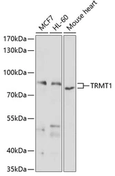 Anti-TRMT1 antibody used in Western Blot (WB). GTX65595