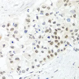 Anti-TRMT1 antibody used in IHC (Paraffin sections) (IHC-P). GTX65595