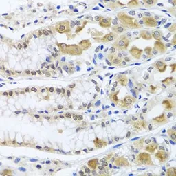 Anti-TRMT1 antibody used in IHC (Paraffin sections) (IHC-P). GTX65595