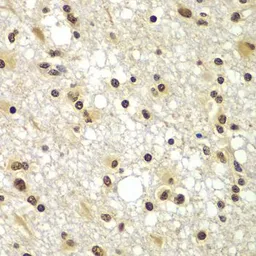 Anti-ZNF20 antibody used in IHC (Paraffin sections) (IHC-P). GTX65596