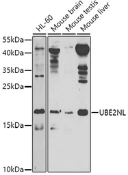 Anti-UBE2NL antibody used in Western Blot (WB). GTX65599