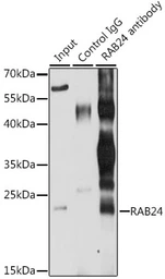 Anti-RAB24 antibody used in Immunoprecipitation (IP). GTX65600