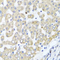 Anti-RAB24 antibody used in IHC (Paraffin sections) (IHC-P). GTX65600