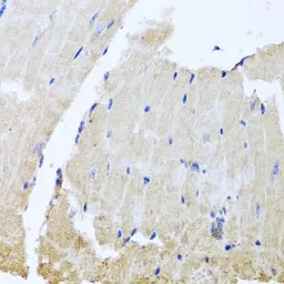 Anti-RAB24 antibody used in IHC (Paraffin sections) (IHC-P). GTX65600