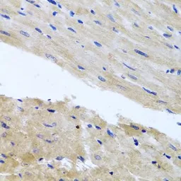 Anti-RAB24 antibody used in IHC (Paraffin sections) (IHC-P). GTX65600