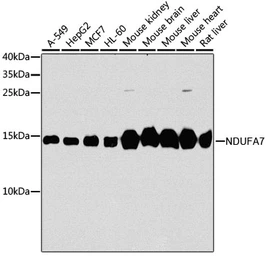 Anti-NDUFA7 antibody used in Western Blot (WB). GTX65602