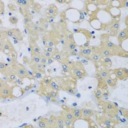 Anti-NDUFA7 antibody used in IHC (Paraffin sections) (IHC-P). GTX65602