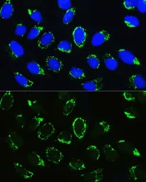 Anti-PTCD3 antibody used in Immunocytochemistry/ Immunofluorescence (ICC/IF). GTX65603