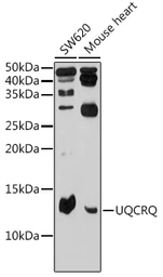Anti-UQCRQ antibody used in Western Blot (WB). GTX65607
