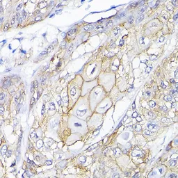 Anti-SEMA4F antibody used in IHC (Paraffin sections) (IHC-P). GTX65618