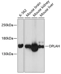 Anti-OPLAH antibody used in Western Blot (WB). GTX65621