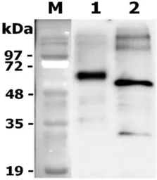 Rat Progranulins protein, DDDDK tag. GTX65638-pro