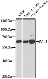 Anti-PAK2 antibody used in Western Blot (WB). GTX65807