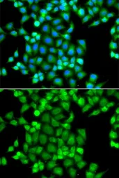 Anti-PAK2 antibody used in Immunocytochemistry/ Immunofluorescence (ICC/IF). GTX65807