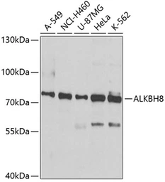 Anti-ALKBH8 antibody used in Western Blot (WB). GTX65809