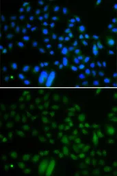 Anti-ALKBH8 antibody used in Immunocytochemistry/ Immunofluorescence (ICC/IF). GTX65809