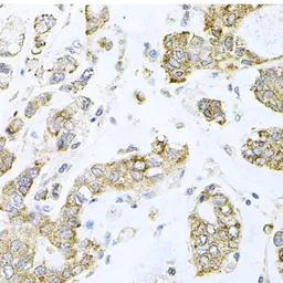 Anti-ALKBH8 antibody used in IHC (Paraffin sections) (IHC-P). GTX65809